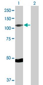 RPS6KA5 Antibody in Western Blot (WB)