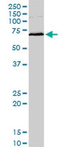 MAPKAPK2 Antibody in Western Blot (WB)