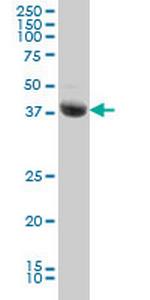 STK17B Antibody in Western Blot (WB)