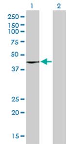 PSCD3 Antibody in Western Blot (WB)