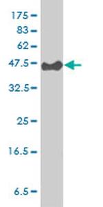 PSCD3 Antibody in Western Blot (WB)