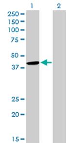 CYTH2 Antibody in Western Blot (WB)