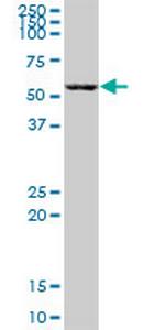 ZBTB22 Antibody in Western Blot (WB)