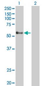 GPR56 Antibody in Western Blot (WB)