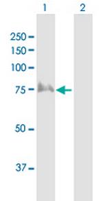 TRIP10 Antibody in Western Blot (WB)