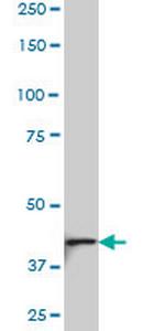 NDST3 Antibody in Western Blot (WB)