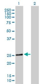 RAB28 Antibody in Western Blot (WB)