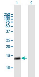 RAB28 Antibody in Western Blot (WB)