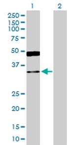 GRHPR Antibody in Western Blot (WB)