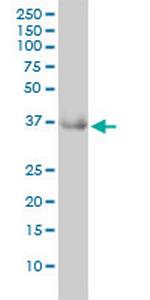 GRHPR Antibody in Western Blot (WB)