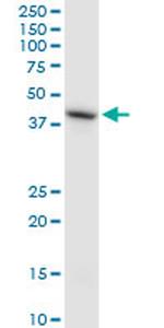 HS6ST1 Antibody in Western Blot (WB)