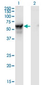 NMT2 Antibody in Western Blot (WB)