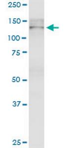 TJP2 Antibody in Western Blot (WB)