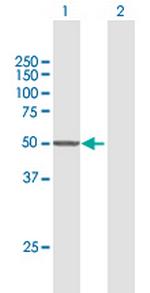 CYP7B1 Antibody in Western Blot (WB)