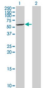 CYP7B1 Antibody in Western Blot (WB)