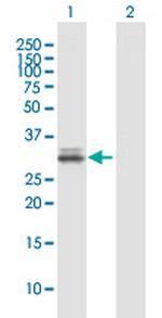 NCR1 Antibody in Western Blot (WB)