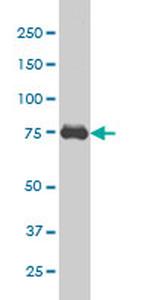 CRSP6 Antibody in Western Blot (WB)