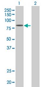 CRSP7 Antibody in Western Blot (WB)