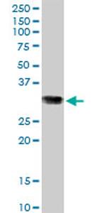 GSTO1 Antibody in Western Blot (WB)