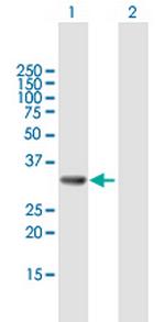 GGPS1 Antibody in Western Blot (WB)