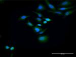 HOMER2 Antibody in Immunocytochemistry (ICC/IF)