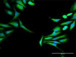 HOMER1 Antibody in Immunocytochemistry (ICC/IF)