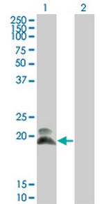 HAND2 Antibody in Western Blot (WB)