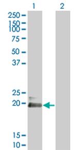 HAND2 Antibody in Western Blot (WB)