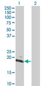 HAND2 Antibody in Western Blot (WB)