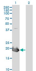 HAND2 Antibody in Western Blot (WB)