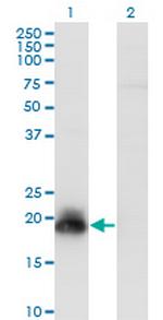 HAND2 Antibody in Western Blot (WB)