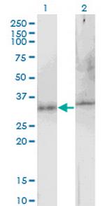 ATG5 Antibody in Western Blot (WB)