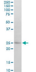 ATG5 Antibody in Western Blot (WB)