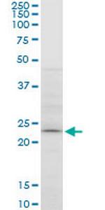 ATG5 Antibody in Western Blot (WB)