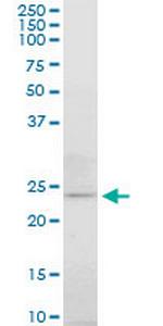 ATG5 Antibody in Western Blot (WB)