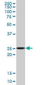 ATG5 Antibody in Western Blot (WB)