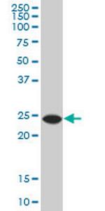 ATG5 Antibody in Western Blot (WB)