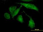 ROCK2 Antibody in Immunocytochemistry (ICC/IF)