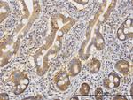 ROCK2 Antibody in Immunohistochemistry (Paraffin) (IHC (P))