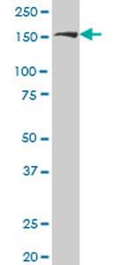 ROCK2 Antibody in Western Blot (WB)