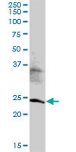 MED20 Antibody in Western Blot (WB)