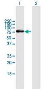 ZNF254 Antibody in Western Blot (WB)