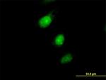 MAD2L1BP Antibody in Immunocytochemistry (ICC/IF)