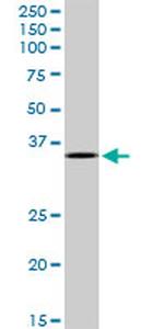 MAD2L1BP Antibody in Western Blot (WB)