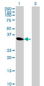 MAD2L1BP Antibody in Western Blot (WB)