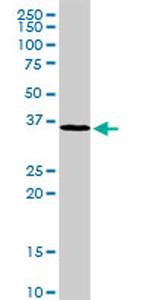 MAD2L1BP Antibody in Western Blot (WB)