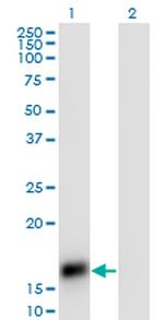 CART Antibody in Western Blot (WB)