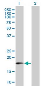 MTRF1 Antibody in Western Blot (WB)