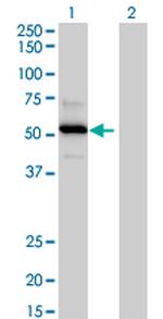 TRAF4 Antibody in Western Blot (WB)