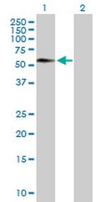 FEZ1 Antibody in Western Blot (WB)